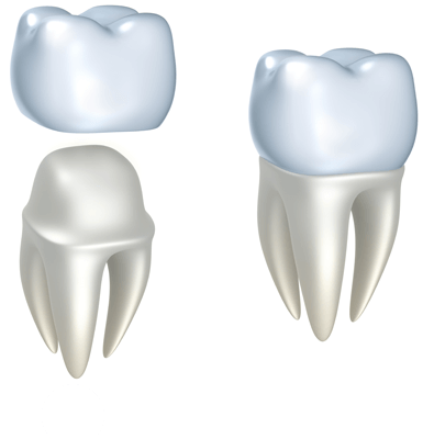 crowns tooth